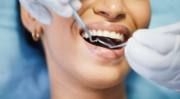 Best Dental Abscess Treatment in Flatonia, TX